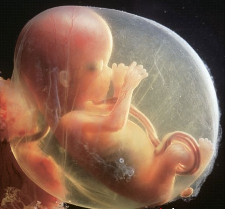 怀孕三个月胎儿图 怀孕三个月男女胎儿图片