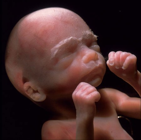 怀孕三个月胎儿图 怀孕三个月男女胎儿图片